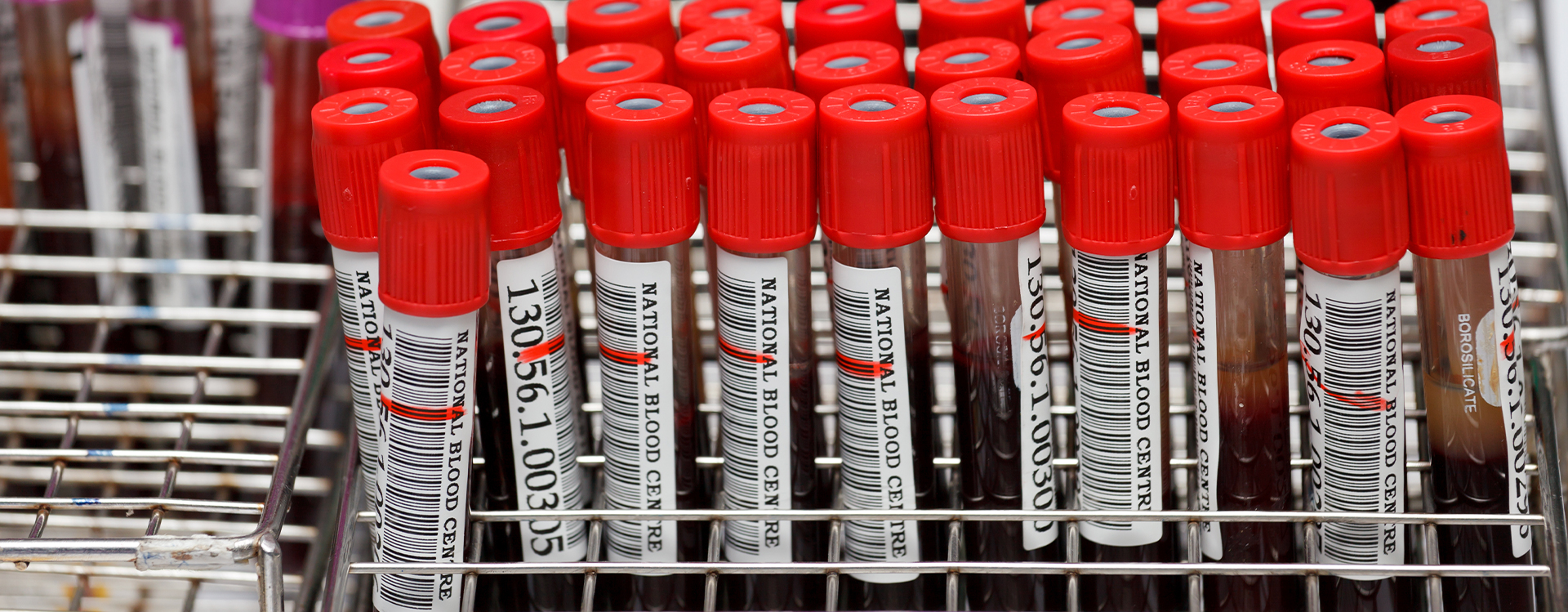 Labeling Labs and Laboratories